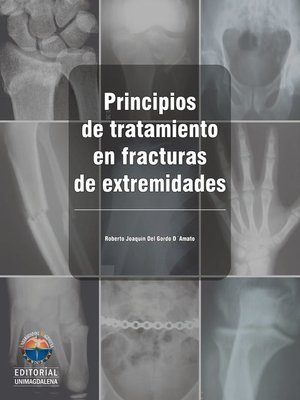 cover image of Principios de tratamiento en fracturas de extremidades